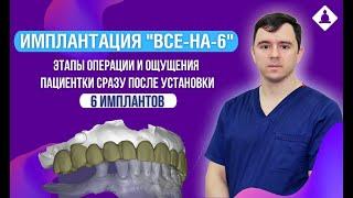 Имплантация «Все-на-6» по технологии R2Gate. Операция и первые ощущения пациентки!