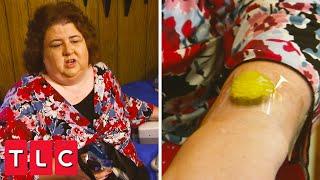 Cheapskate Uses Pickles to Treat Skin Problems!?! | Extreme Cheapskates