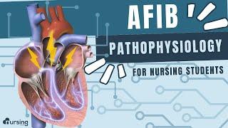 AFIB (Atrial Fibrillation) Pathophysiology- Cardiac Nursing