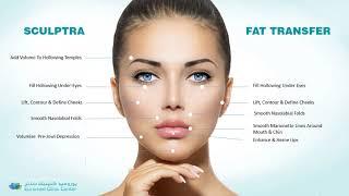 Sculptra Fillers & Fat Transfer Treatment in Dubai @Euromed® Clinic #fillers #selfcare