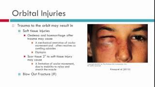 Effects of Obital Injury