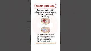 #multiplechoicequestion #anatomy #pain