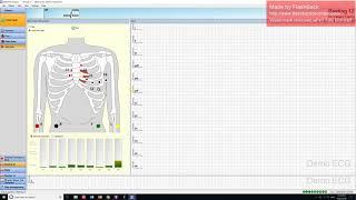 Amedtech to Best Practice ECG Intergration