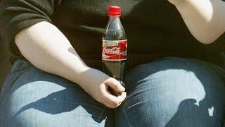 Mədəkiçiltmə əməliyyatından sonra cola içmək niyə olmaz?