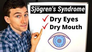 What is Sjögren's Syndrome? Eye Doctor Explains