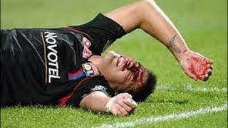 Gekste Horror Voetbal Fouten / Tackles