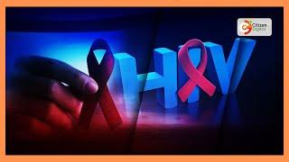 Medics raise alarm over rising advanced HIV disease