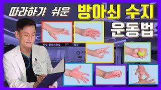 방아쇠수지증후군 수술없이 치료하는 운동법