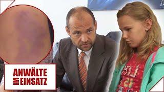 Vom Papa m*sshandelt ?    Fiona(10) spricht GAR NICHT mehr | 1/2 | Anwälte im Einsatz | SAT.1