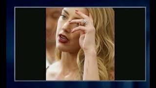 Amber Heard explains photos of herself with scars on the red carpet