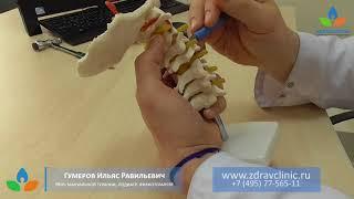 Лечение остеохондроза шейного отдела - рассказывает врач
