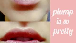 Perfect Lips with Filler at Fusion Medispa Tampa