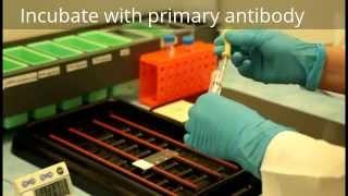 Immunohistochemistry - Procedure