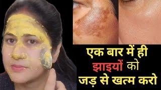 Instant pigmentation remove athome || How to remove pigmentation