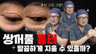 압구정재봉틀의 쌍꺼풀 흉터제거수술로 얼마나 개선될 수 있을까?