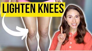 *BEST* SKINCARE TO LIGHTEN KNEES AND ELBOWS | Dermatologist