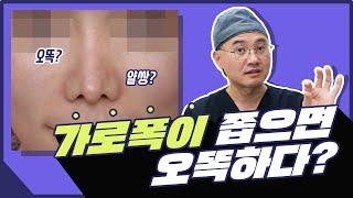 𝐐.오똑하고 얄쌍하고 가로폭이 좁은데 코가 망할수가 있나요? 𝗔.네 있습니다 [코재수술] #이규호원장님 그레이스오앤영 (ep.2)