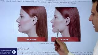 Kybella Treatment Beverly Hills