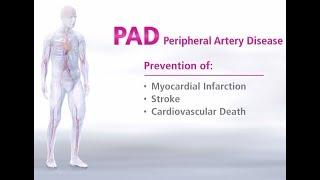 What is Peripheral Artery Disease - Mechanism of Disease