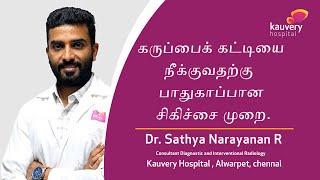 Safe Procedure to Remove Uterine Fibroids | Kauvery Hospital Chennai | Tamil