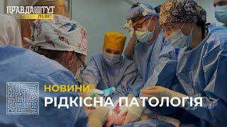 На заході України вперше прооперували немовля, яке народилося з кишківником назовні