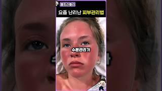 요즘 난리난 여름철 피부관리 #알록울트라올라 #찝프팅 #피부관리