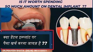 क्या डेंटल इम्प्लांट पर पैसा खर्च करना जायज़ है ??Is It Worth Spending So Much on Dental Implants?