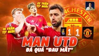 HÃY XEM MAN UTD ĐÁ BÓNG NẾU BẠN MUỐN ĐAU MẮT