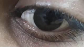 Artificial eye that looks real and moves with better eye