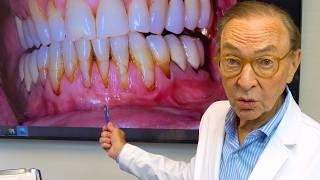 Brushing Your Teeth TOO Hard? Here's What Happens...