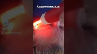 дарсонвализация