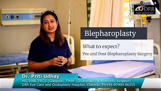 Blepharoplasty recovery day by day explained by Dr.Priti Udhay