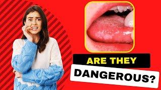 What Causes White Spots On Side Of Tongue? How To Prevent It