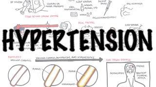 Hypertension - Overview (causes, pathophysiology, investigations, treatment