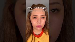 【小鼻縮小だけでこんなに変わるの！？】ダウンタイム大公開️ #美容整形 #astrabeautyclinic #鼻整形 #小鼻縮小