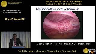 Mesh location - Is there really a gold standard?