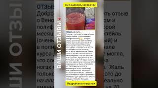 Уменьшились звездочки