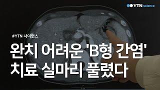 완치 어려운 'B형 간염'...치료 실마리 풀렸다 / YTN 사이언스