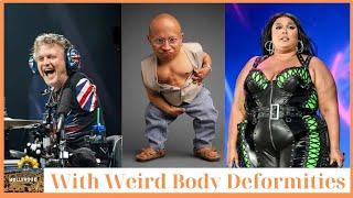 LIVE:12 Celebrities With Weird Body Deformities | Then and now 2025