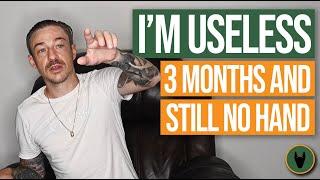 I Feel USELESS! 3 Months With No Hand - No end in site!