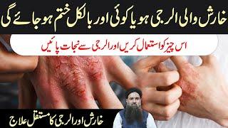 Kharish Ka ilaj | Allergy Ka ilaj | itching Ka ilaj | How to Stop Skin itching Dr Sharafat Ali 2021