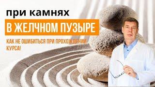 Камни желчного пузыря и полипы: как не ошибиться с приемом препаратов при ЖКБ