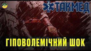 ТАКМЕД. Гіповолемічний шок. Випуск 10