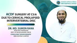 ACDF surgery at C5/6 due to cervical prolapsed intervertebral disc by Dr. Md. Sumon Rana.