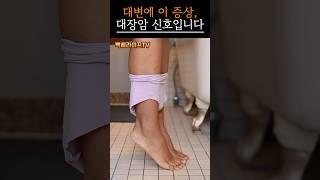 대변 볼 때 이 느낌, 대장암 신호입니다｜지금 바로 확인