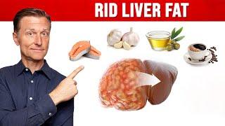 The BEST Foods for a Fatty Liver (MUST WATCH)