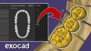 Bridge EXOCAD. 2024 Tutorial