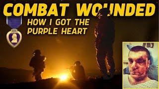 Combat Wounded | How I Got the Purple Heart