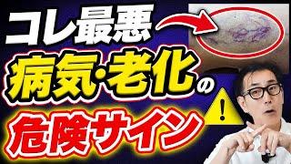 【放置厳禁】絶対に見逃さないで！深刻な病気につながる危険サインと対処法を教えます！【細絡 老化】