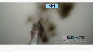 닥터에클린 윙클 더클 시연 영상